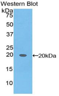 Alpha-Fetoprotein (AFP) Polyclonal Antibody - image 3
