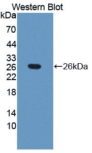 Alpha-Fetoprotein (AFP) Polyclonal Antibody - image 2