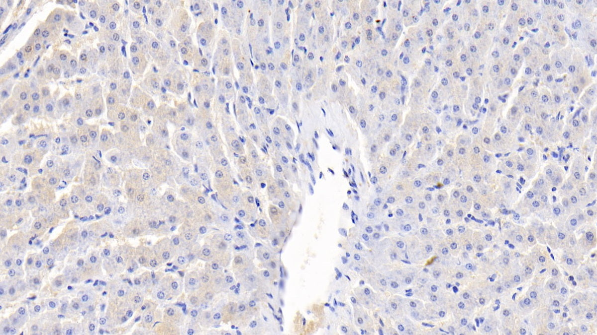 Alpha-Fetoprotein (AFP) Polyclonal Antibody - image 3