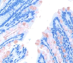 Carcinoembryonic Antigen (CEA) Polyclonal Antibody - image 3
