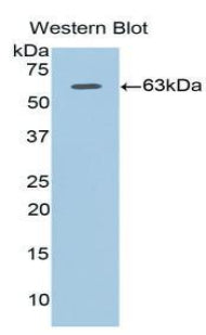 Adiponectin Receptor 1 (ADIPOR1) Polyclonal Antibody - image 2