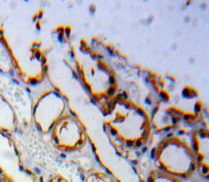 Adiponectin Receptor 1 (ADIPOR1) Polyclonal Antibody - image 3