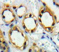 Adiponectin Receptor 1 (ADIPOR1) Polyclonal Antibody - image 3