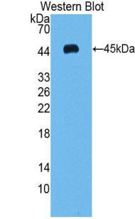 Used in DAB staining on fromalin fixed paraffin-embedded Bowels tissue