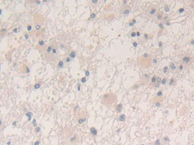 DAB staining on IHC-P; Samples: Human Pancreas Tissue.
