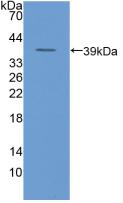 Plasminogen Activator, Urokinase Receptor (uPAR) Polyclonal Antibody - image 2