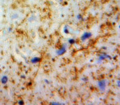 Plasminogen Activator, Urokinase Receptor (uPAR) Polyclonal Antibody - image 3