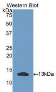 Plasminogen Activator, Urokinase Receptor (uPAR) Polyclonal Antibody - image 2