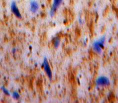 Plasminogen Activator, Urokinase Receptor (uPAR) Polyclonal Antibody - image 3