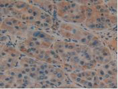 Plasminogen Activator, Urokinase Receptor (uPAR) Polyclonal Antibody - image 5