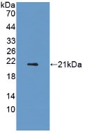 DAB staining on IHC-P; Samples: Rat Testis Tissue; Primary Ab: 10µg/ml Rabbit Anti-Rat ADIPOR2 Antibody Second Ab: 2µg/mL HRP-Linked Caprine Anti-Rabbit IgG Polyclonal Antibody