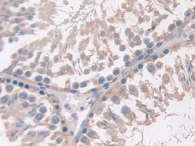 DAB staining on IHC-P; Samples: Rat Heart Tissue.