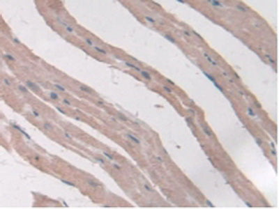Adiponectin Receptor 2 (ADIPOR2) Polyclonal Antibody - image 5
