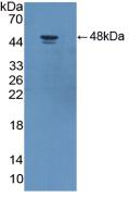 DAB staining on IHC-P; Samples: Human Kidney Tissue; Primary Ab: 20μg/ml Rabbit Anti-Human ADIPOR2 Antibody Second Ab: 2µg/mL HRP-Linked Caprine Anti-Rabbit IgG Polyclonal Antibody