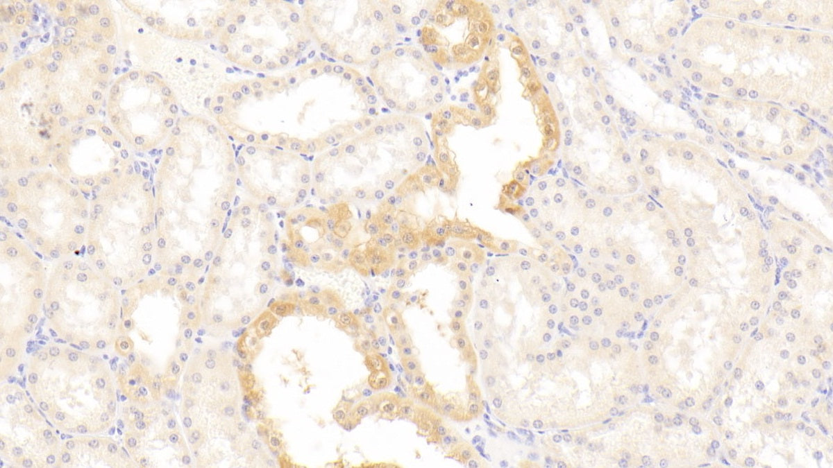 DAB staining on IHC-P. Samples: Human Tissue)