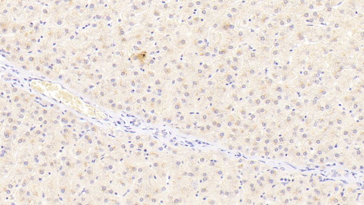Adiponectin Receptor 2 (ADIPOR2) Polyclonal Antibody - image 5