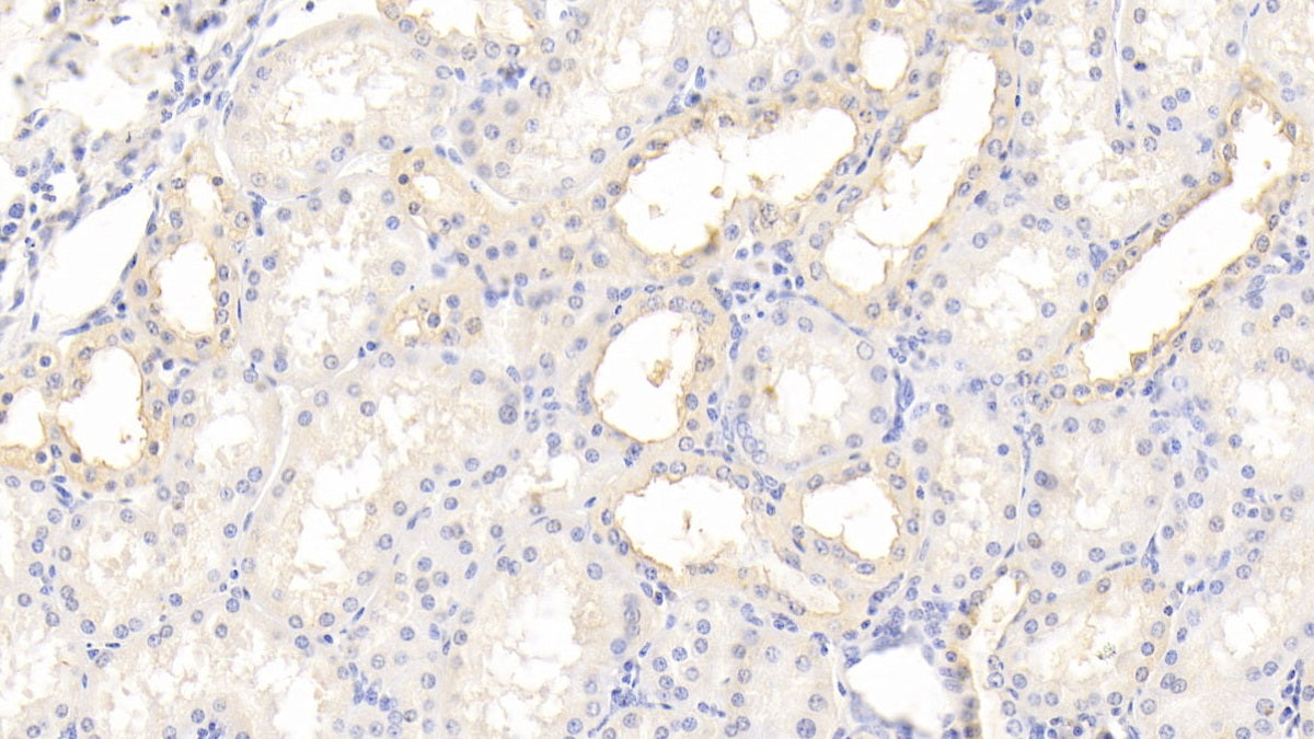 Tissue Inhibitors Of Metalloproteinase 3 (TIMP3) Polyclonal Antibody - image 4