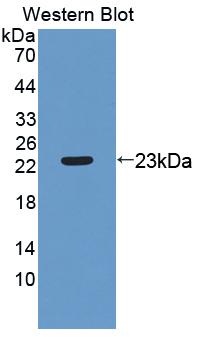 Tissue Inhibitors Of Metalloproteinase 2 (TIMP2) Polyclonal Antibody - image 2