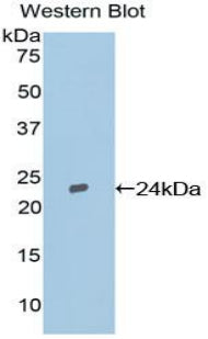 Tissue Inhibitors Of Metalloproteinase 2 (TIMP2) Polyclonal Antibody - image 2
