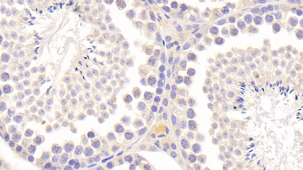 DABstainingonIHC-P.Samples:MouseTissue)