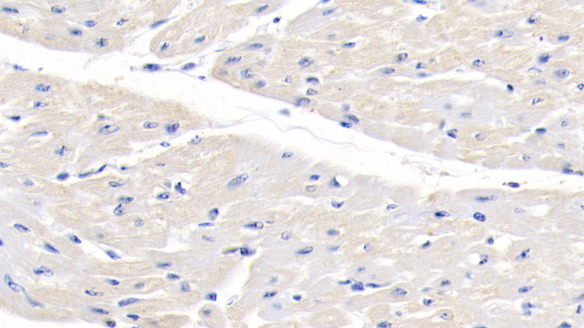Tissue Inhibitors Of Metalloproteinase 2 (TIMP2) Polyclonal Antibody - image 3