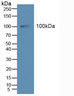 Western Blot; Sample: Recombinant Tie2, Human.