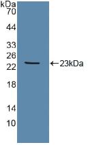 TEK Tyrosine Kinase, Endothelial (Tie2) Polyclonal Antibody - image 3