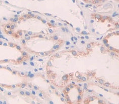 TEK Tyrosine Kinase, Endothelial (Tie2) Polyclonal Antibody - image 4