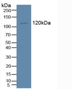 Western Blot; Sample: Recombinant Tie1, Human.