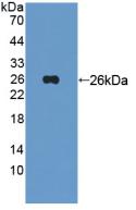 DAB staining on IHC-P; Samples: Human Cerebrum Tissue; Primary Ab: 20μg/ml Rabbit Anti-Human Tie1 Antibody Second Ab: 2µg/mL HRP-Linked Caprine Anti-Rabbit IgG Polyclonal Antibody