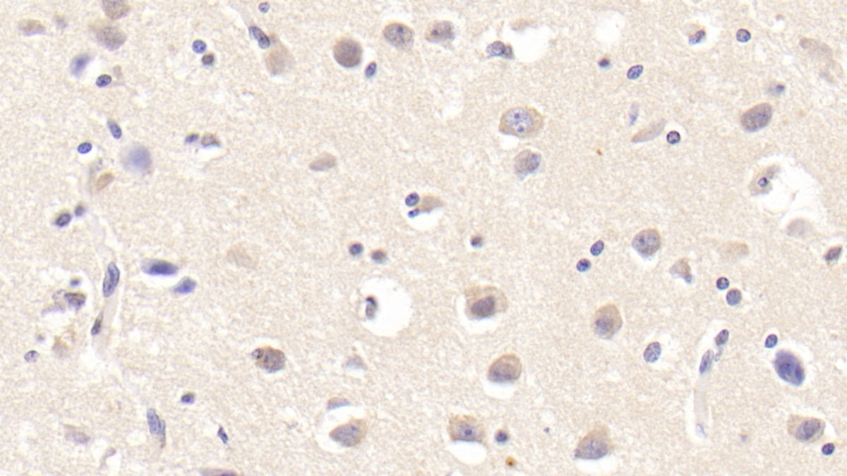DAB staining on fromalin fixed paraffin- embedded lung tissue)