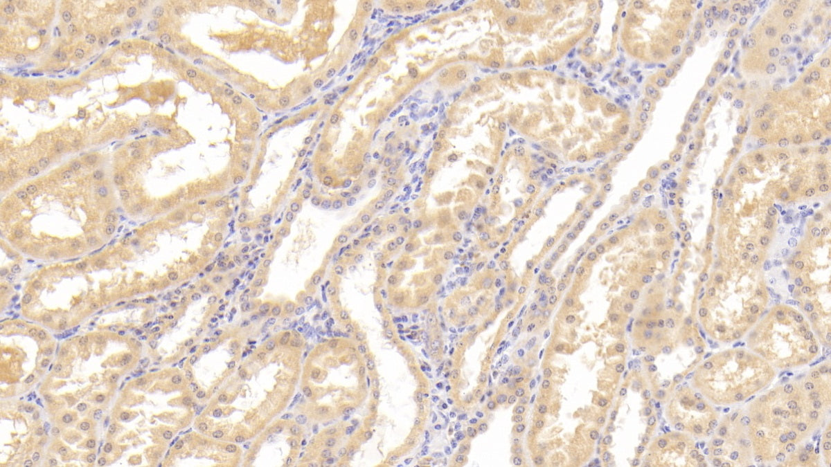 Tyrosine Kinase With Immunoglobulin Like And EGF Like Domains Protein 1 (Tie1) Polyclonal Antibody - image 5