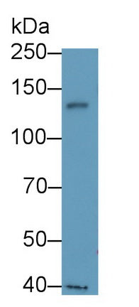 DAB staining on IHC-P; Samples: Human Kidney Tissue;  Primary Ab: 20μg/ml Rabbit Anti-Human Tie1 Antibody Second Ab: 2µg/mL HRP-Linked Caprine Anti-Rabbit IgG Polyclonal Antibody