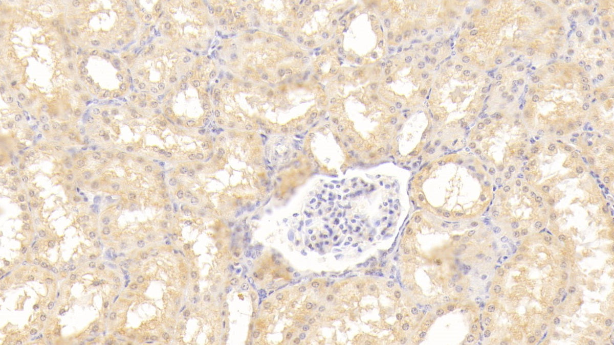 Tyrosine Kinase With Immunoglobulin Like And EGF Like Domains Protein 1 (Tie1) Polyclonal Antibody - image 4