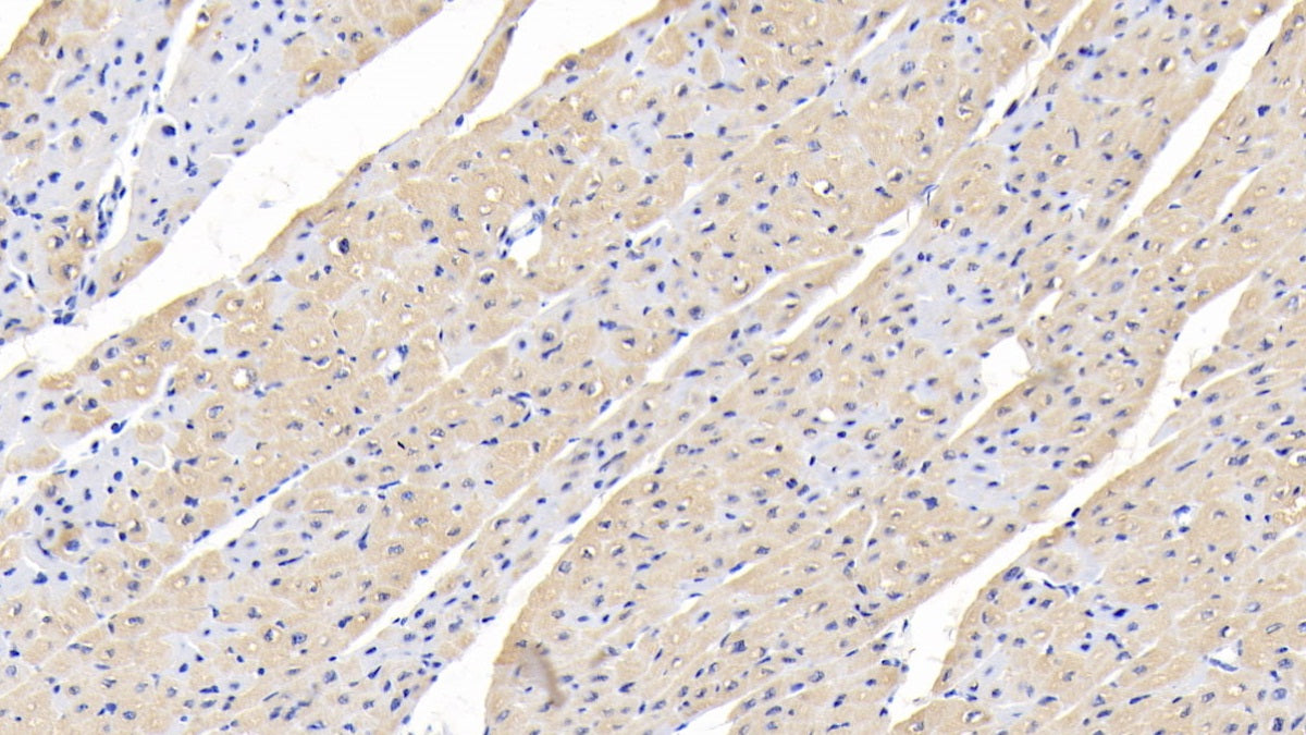 Transforming Growth Factor Beta 1 (TGFb1) Polyclonal Antibody - image 3
