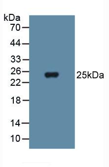 Western Blot; Sample: Human Lung lysate; ; Primary Ab: 1µg/ml Rabbit Anti-Human SOD3 Antibody; Second Ab: 0.2µg/mL HRP-Linked Caprine Anti-Rabbit IgG Polyclonal Antibody;