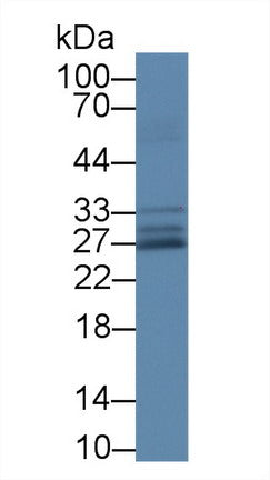 Superoxide Dismutase 3, Extracellular (SOD3) Polyclonal Antibody - image 3
