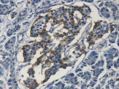 Superoxide Dismutase 3, Extracellular (SOD3) Polyclonal Antibody - image 5