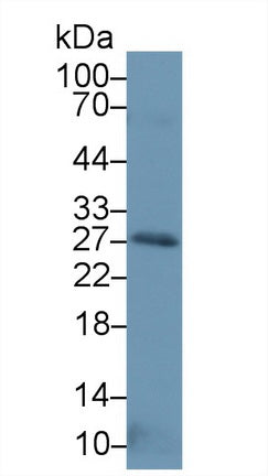 Western Blot; Sample: Recombinant protein.