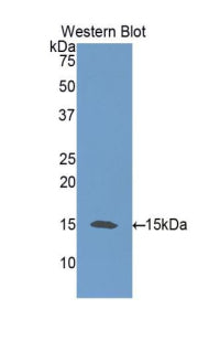 DAB staining on IHC-P; Samples: Human Cerebrum Tissue;  Primary Ab: 20μg/ml Rabbit Anti-Human NT3 Antibody Second Ab: 2µg/mL HRP-Linked Caprine Anti-Rabbit IgG Polyclonal Antibody