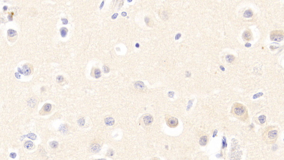 Neurotrophin 3 (NT3) Polyclonal Antibody - image 4