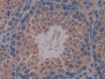 DAB staining on IHC-P; Samples: Mouse Intestine Tissue.