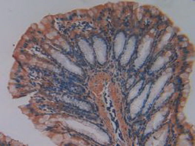 Matrix Metalloproteinase 7 (MMP7) Polyclonal Antibody - image 5
