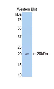DAB staining on IHC-P; Samples: Rat Liver Tissue; Primary Ab: 20μg/ml Rabbit Anti-Rat MMP13 Antibody Second Ab: 2µg/mL HRP-Linked Caprine Anti-Rabbit IgG Polyclonal Antibody