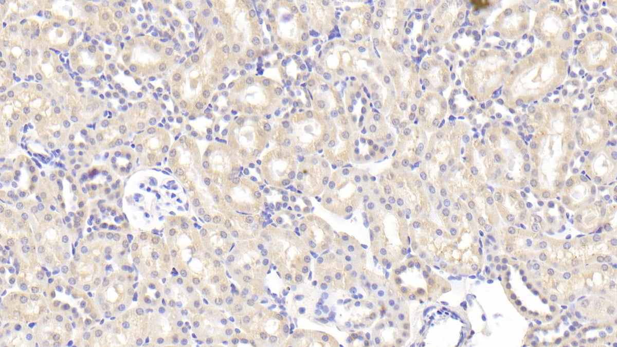 Matrix Metalloproteinase 13 (MMP13) Polyclonal Antibody - image 5