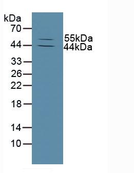 Western Blot; Sample: Recombinant MMP13, Human.