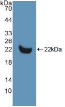 DAB staining on IHC-P; Samples: Human Lymph node Tissue; Primary Ab: 20μg/ml Rabbit Anti-Human MMP13 Antibody Second Ab: 2µg/mL HRP-Linked Caprine Anti-Rabbit IgG Polyclonal Antibody