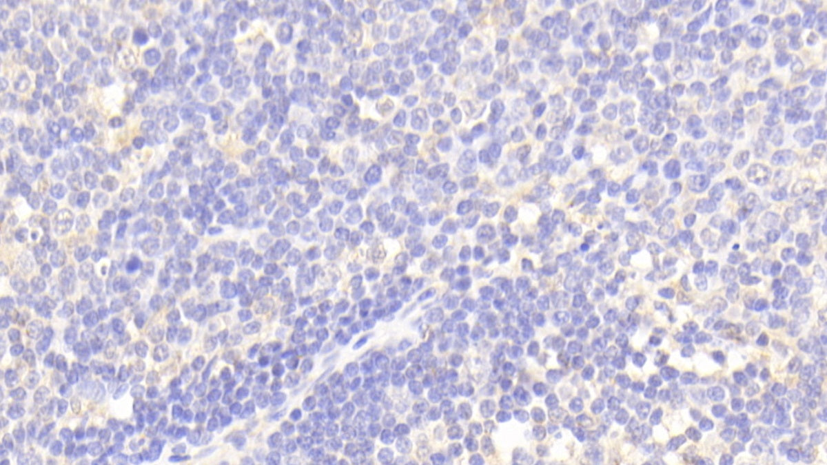 DAB staining on IHC-P. Samples: Human Tissue)