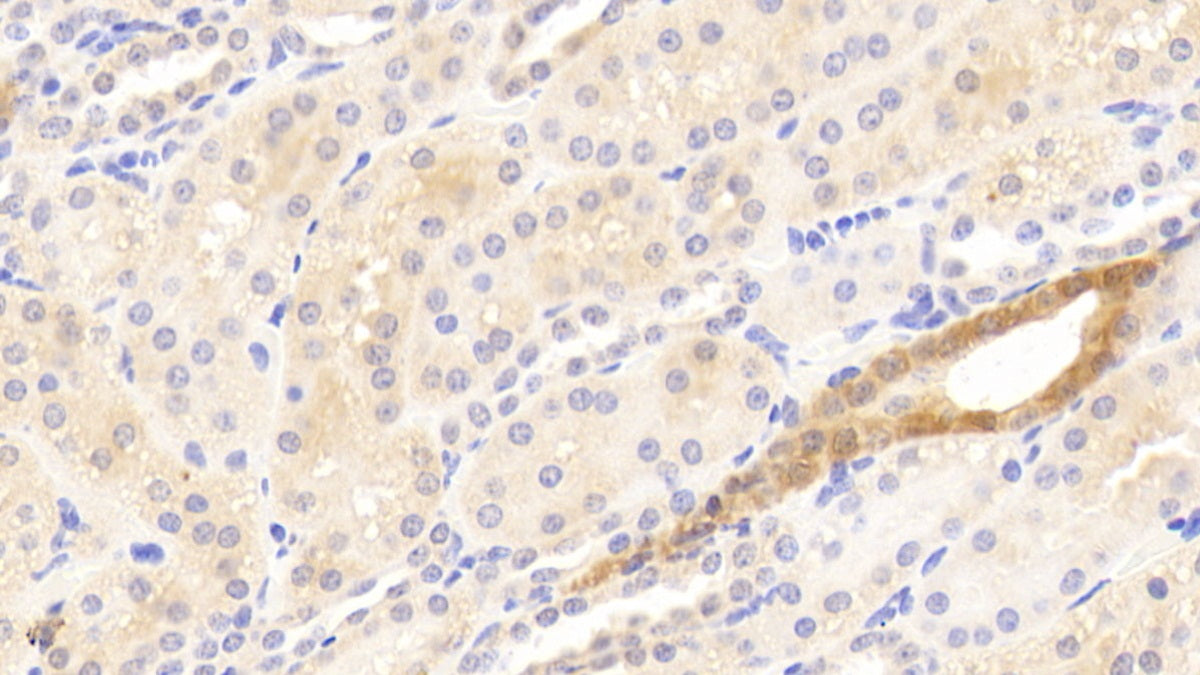 Matrix Metalloproteinase 13 (MMP13) Polyclonal Antibody - image 5