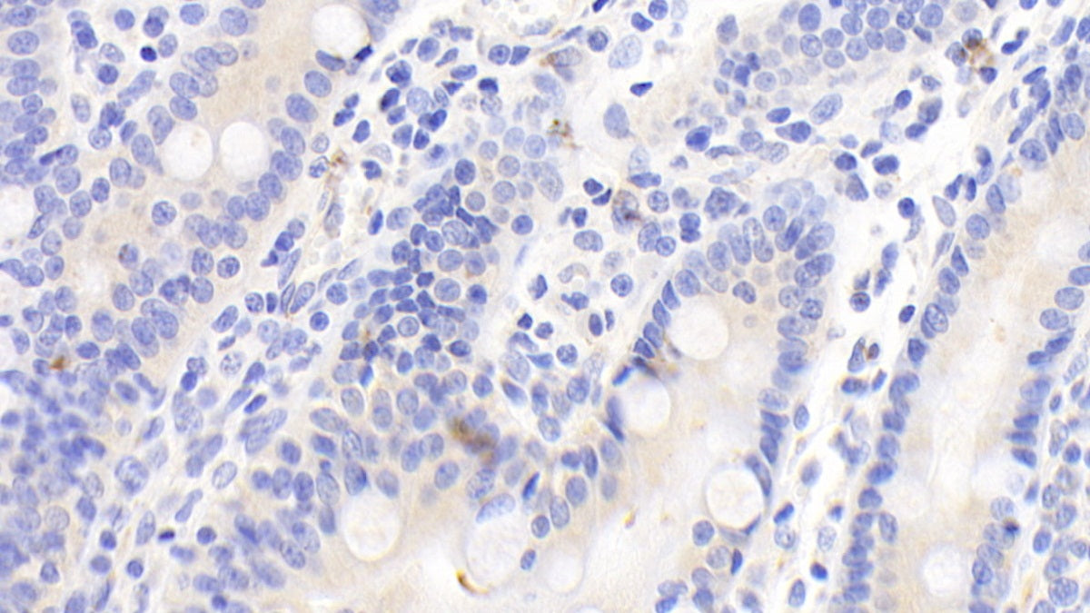 Matrix Metalloproteinase 10 (MMP10) Polyclonal Antibody - image 3